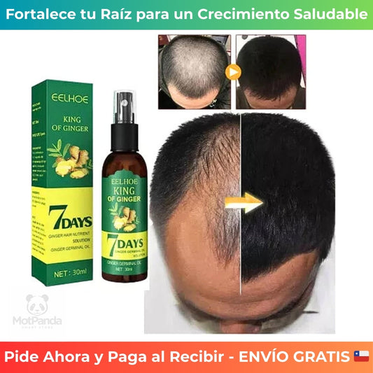 7 DAYS CRECIMIENTO CAPILAR - Detiene la Caída – Logra un Cabello Más Denso