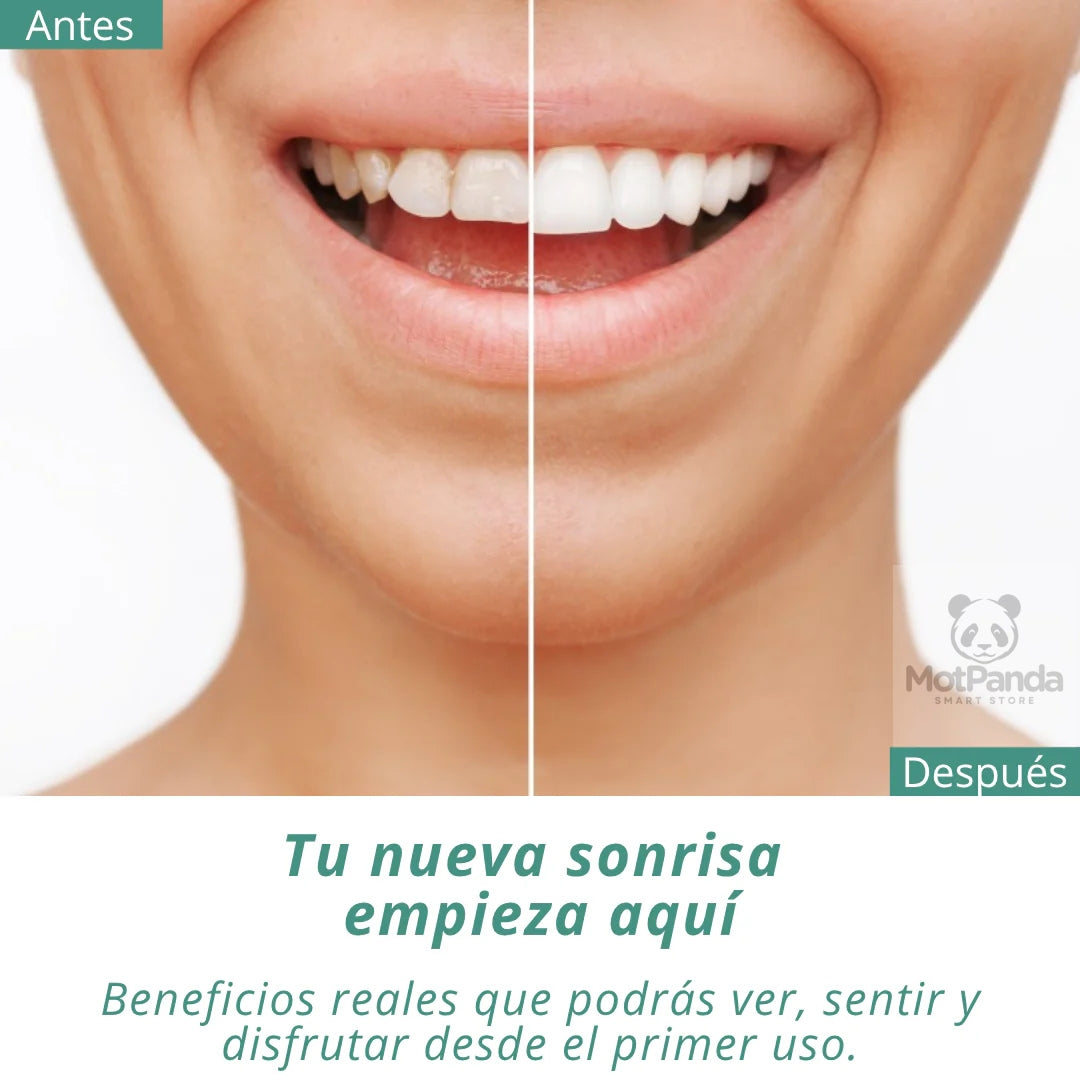 CARILLAS DENTALES CUBRE DIENTES EN SEGUNDOS Y RECUPERA TU SONRISA