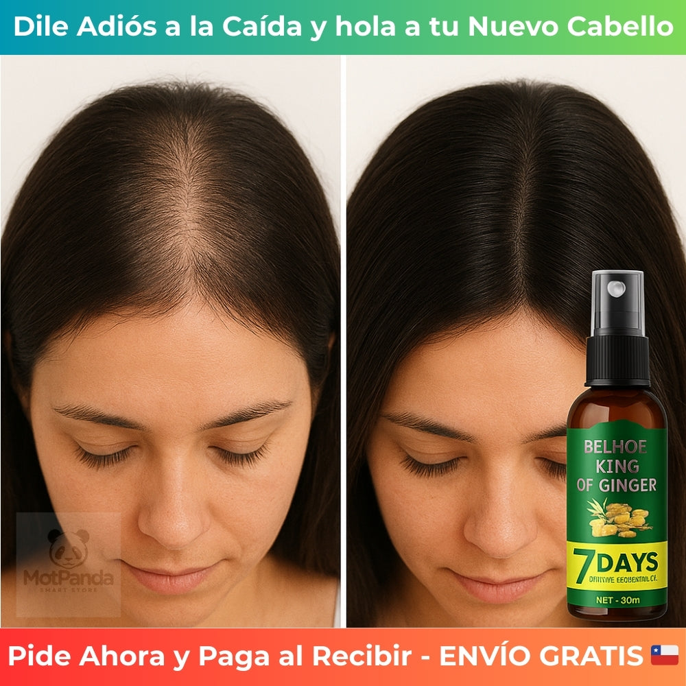 7 DAYS CRECIMIENTO CAPILAR - Detiene la Caída – Logra un Cabello Más Denso