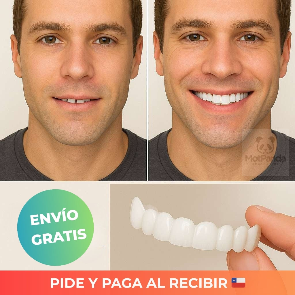 CARILLAS DENTALES CUBRE DIENTES EN SEGUNDOS Y RECUPERA TU SONRISA