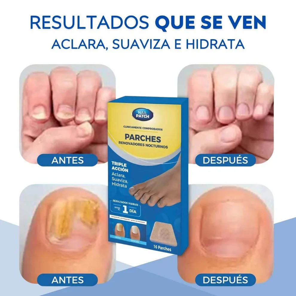 FungaClear™ 2x1 PARCHES ANTIHONGO para Uñas