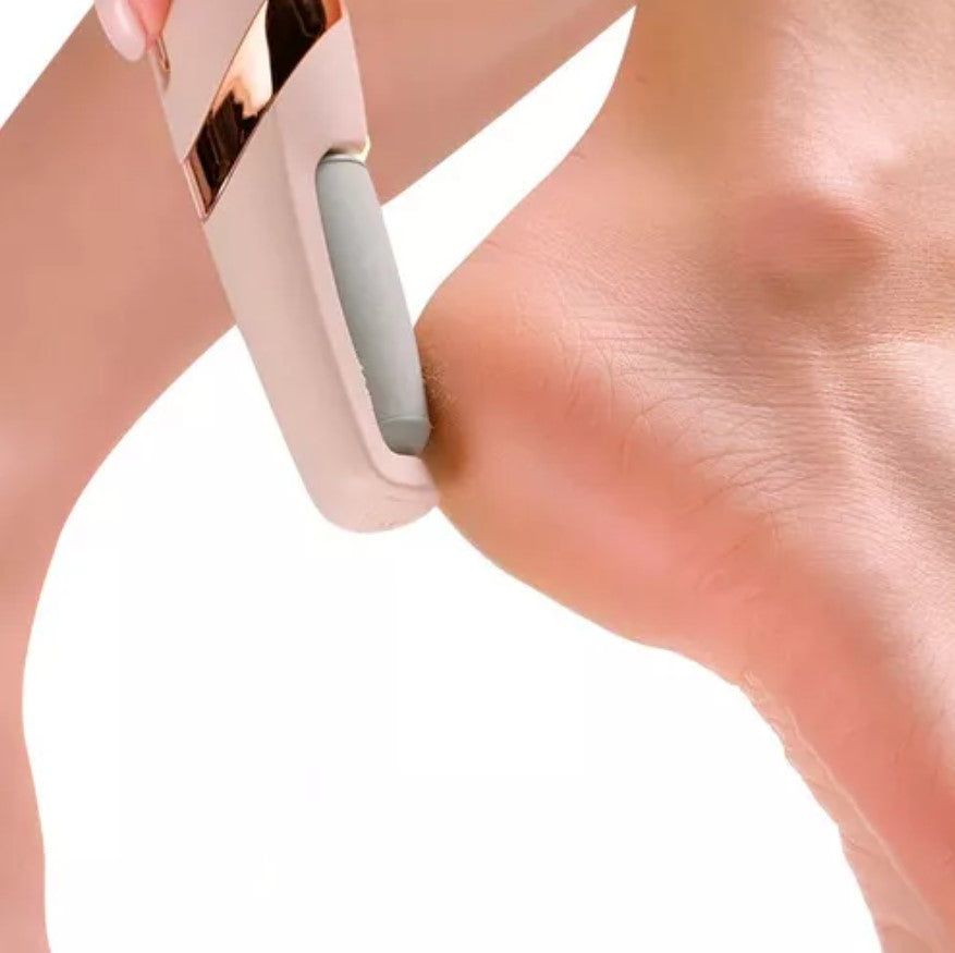 SandalReady Lux™ – LIMADOR DE CALLOS PORTÁTIL - ✅Talones sin grietas