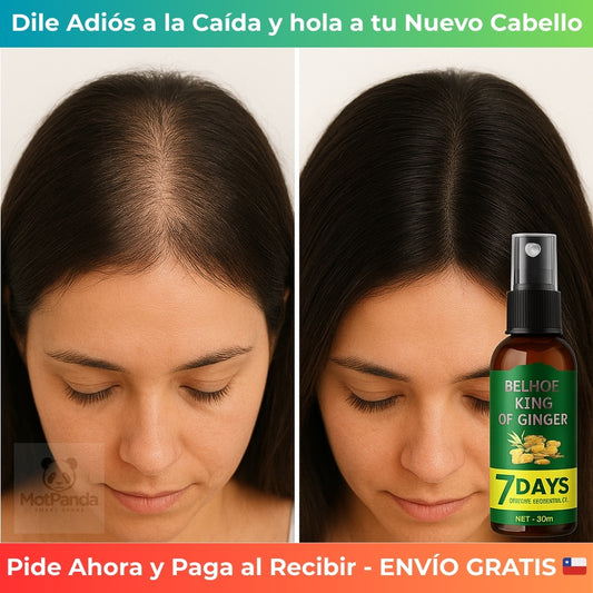 7 DAYS CRECIMIENTO CAPILAR - Detiene la Caída – Logra un Cabello Más Denso