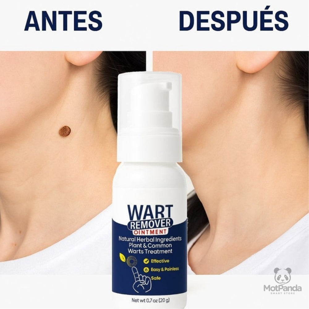 DERMACLEAR™ WART REMOVER - Dile adiós a las verrugas y lunares