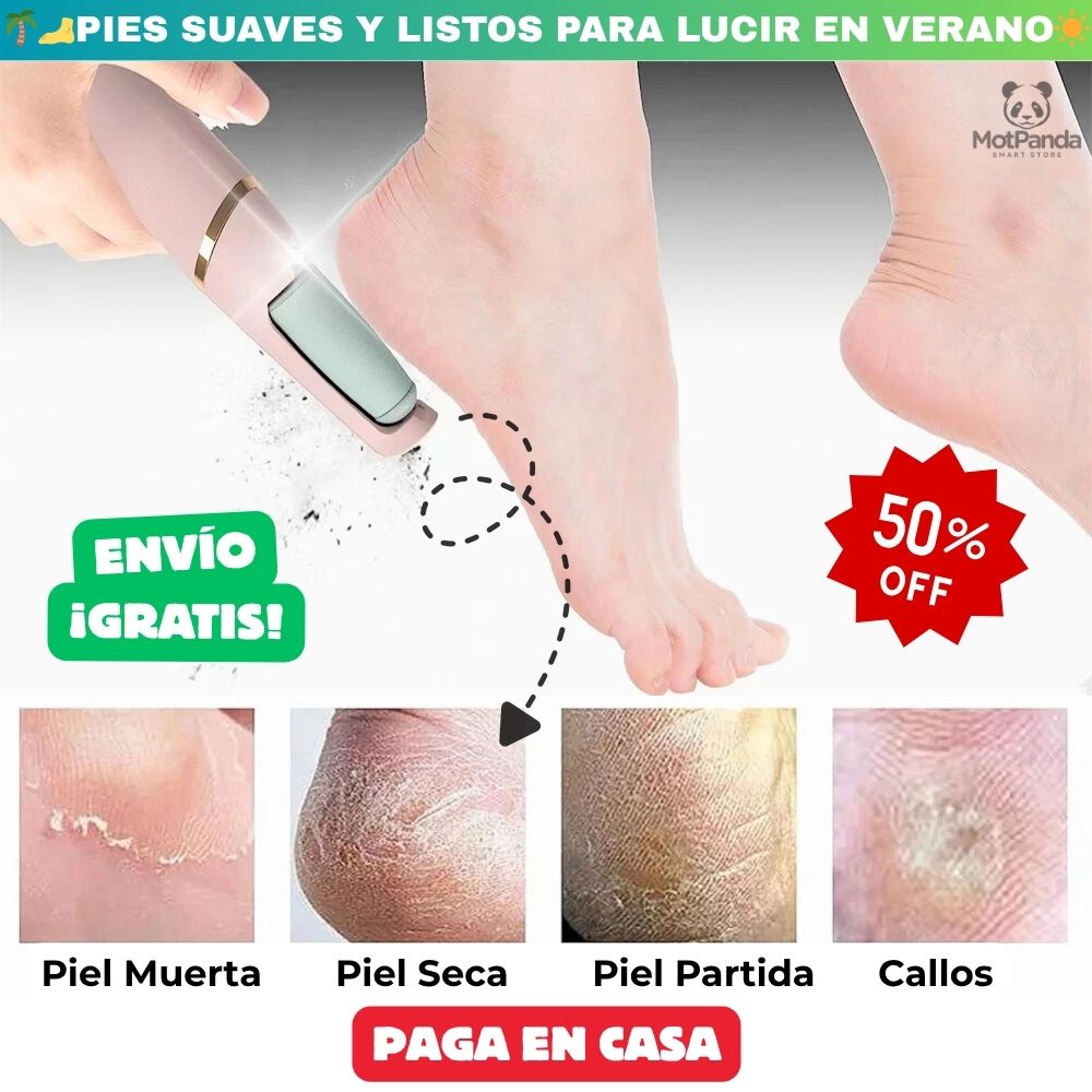 SandalReady Lux™ – LIMADOR DE CALLOS PORTÁTIL - ✅Talones sin grietas