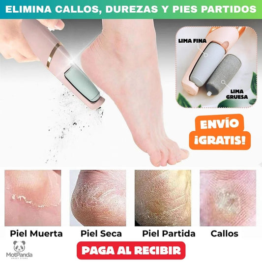 Callus Velvet Spa™ – ELIMINADOR PROFESIONAL DE CALLOS USB Recupera tu pies suaves