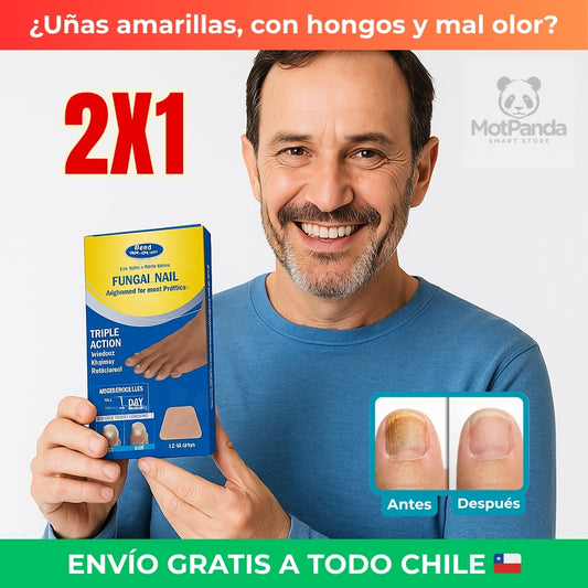 2X1 PARCHES ANTIHONGOS - Uso Fácil y Cómodo - Mejora la apariencia de tus uñas